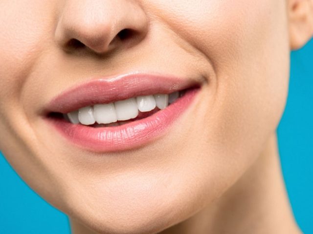 Coconut Oil for Teeth Whitening: Does It Really Work?
