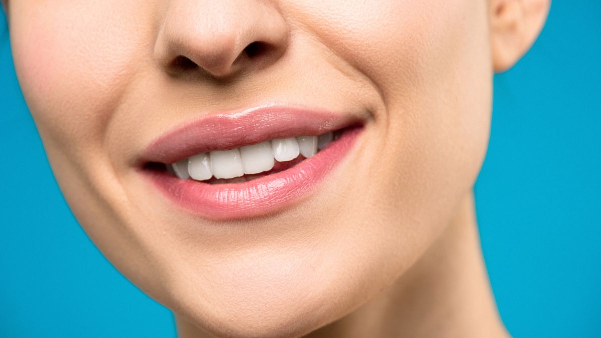A bright white smile, illustrating coconut oil for teeth whitening